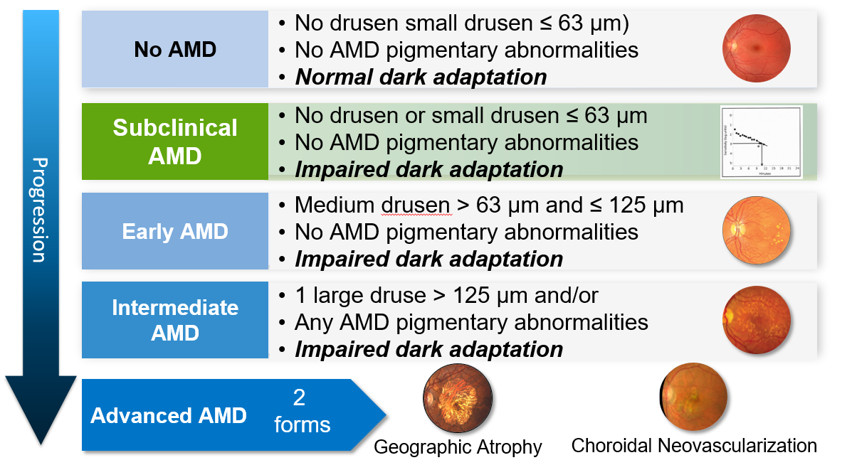 Amd Chart